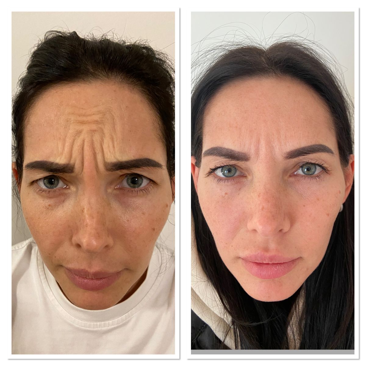 Skinhealth™ Deep Collagen Power Boosting Cream in Serum