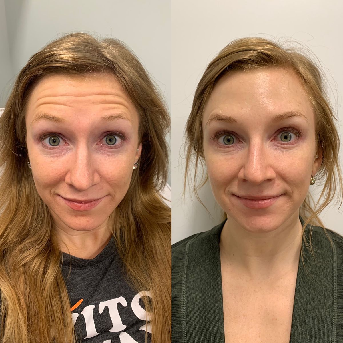 Skinhealth™ Deep Collagen Silk Peptide Ampoule