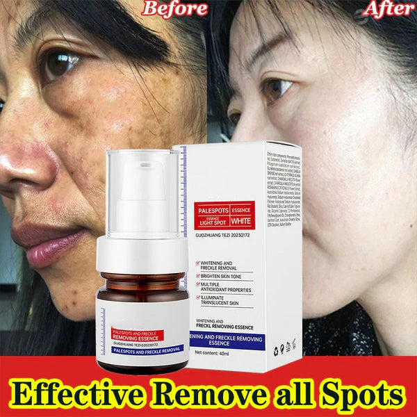 Skinhealth™ Vitamin C Whitening Freckles ESSENCE