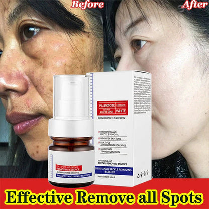 Skinhealth™ Vitamin C Whitening Freckles ESSENCE