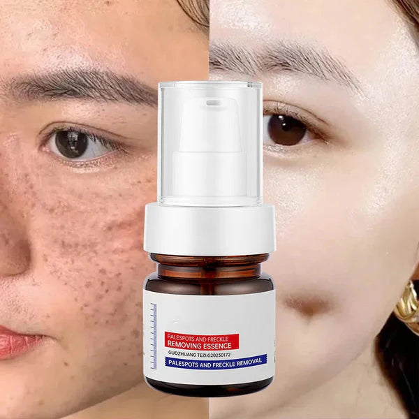 Skinhealth™ Vitamin C Whitening Freckles ESSENCE