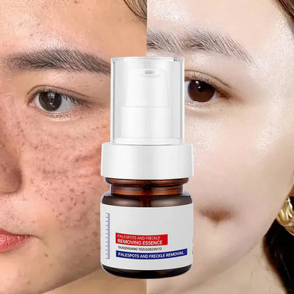 Skinhealth™ Vitamin C Whitening Freckles ESSENCE