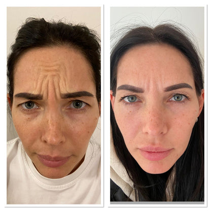 Skinhealth™ Deep Collagen Power Boosting Cream in Serum