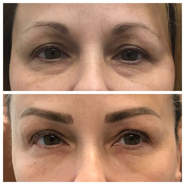 Skinhealth™ Deep Collagen Power Boosting Cream in Serum