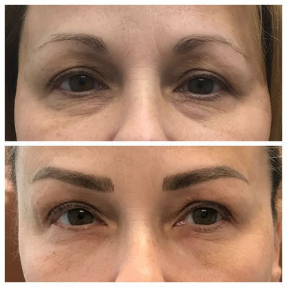 Skinhealth™ Deep Collagen Power Boosting Cream in Serum