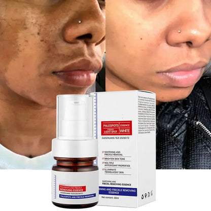 Skinhealth™ Vitamin C Whitening Freckles ESSENCE